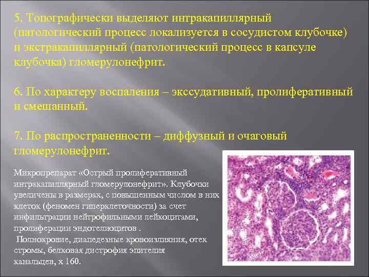 5. Топографически выделяют интракапиллярный (патологический процесс локализуется в сосудистом клубочке) и экстракапиллярный (патологический процесс