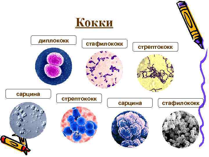 Кокки диплококк сарцина стафилококк стрептококк сарцина стафилококк 