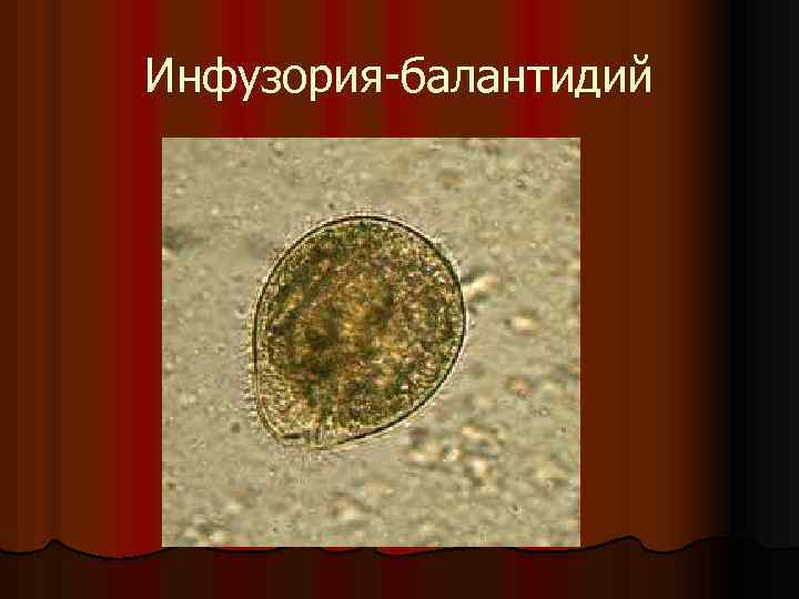 Инфузория-балантидий 