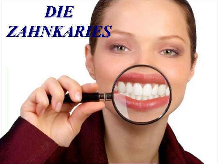 DIE ZAHNKARIES 