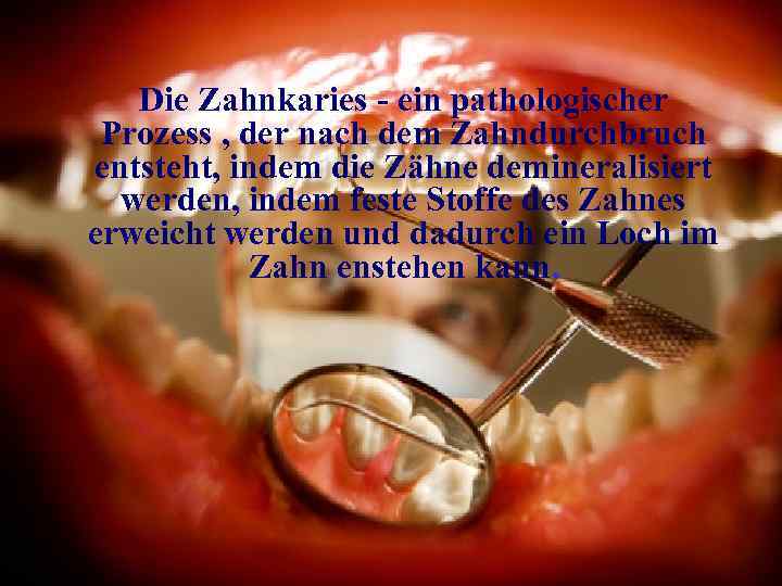 Die Zahnkaries - ein pathologischer Prozess , der nach dem Zahndurchbruch entsteht, indem die