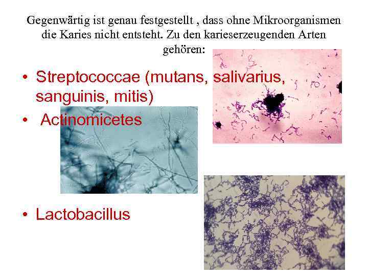 Gegenwärtig ist genau festgestellt , dass ohne Mikroorganismen die Karies nicht entsteht. Zu den