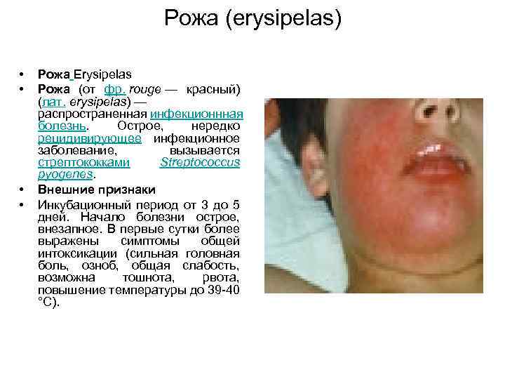 Рожа (erysipelas) • • Рожа Erysipelas Рожа (от фр. rouge — красный) (лат. erysipelas)