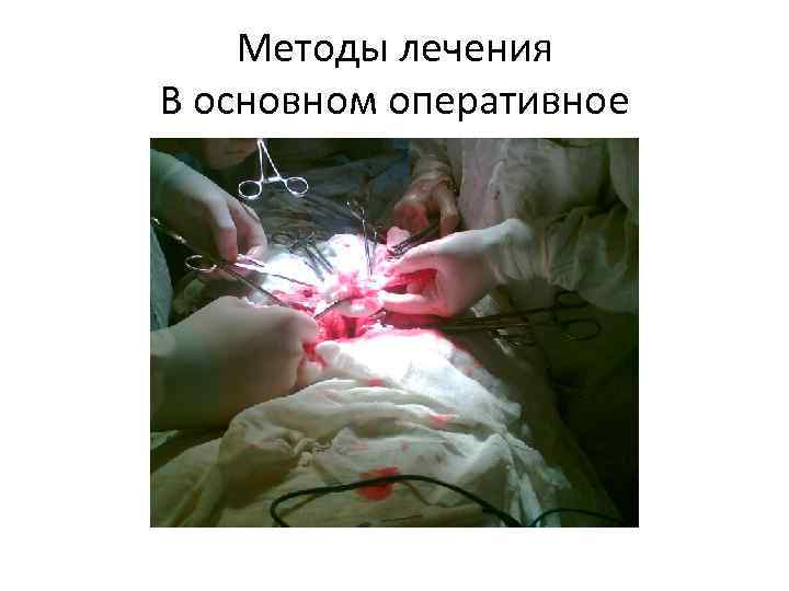 Методы лечения В основном оперативное 