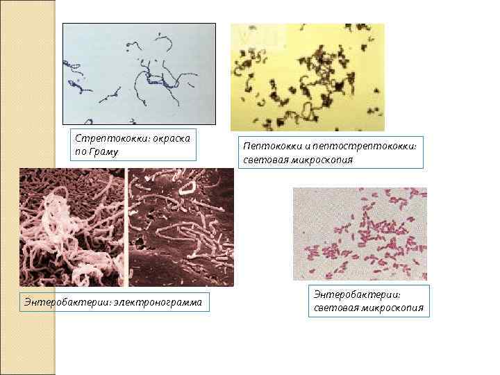 Стрептококки: окраска по Граму Энтеробактерии: электронограмма Пептококки и пептострептококки: световая микроскопия Энтеробактерии: световая микроскопия