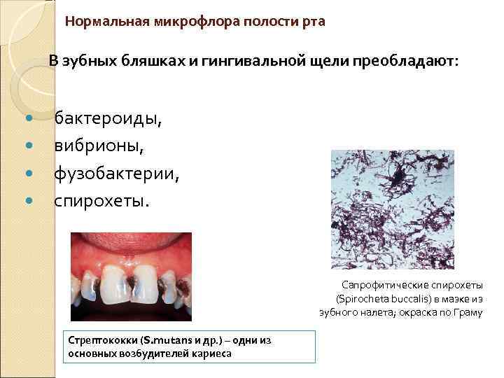 Нормальная микрофлора полости рта В зубных бляшках и гингивальной щели преобладают: бактероиды, вибрионы, фузобактерии,