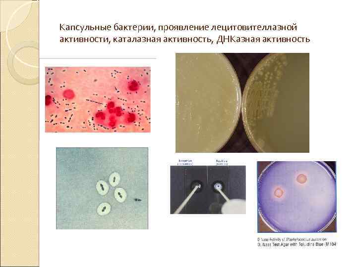 Капсульные бактерии, проявление лецитовителлазной активности, каталазная активность, ДНКазная активность 