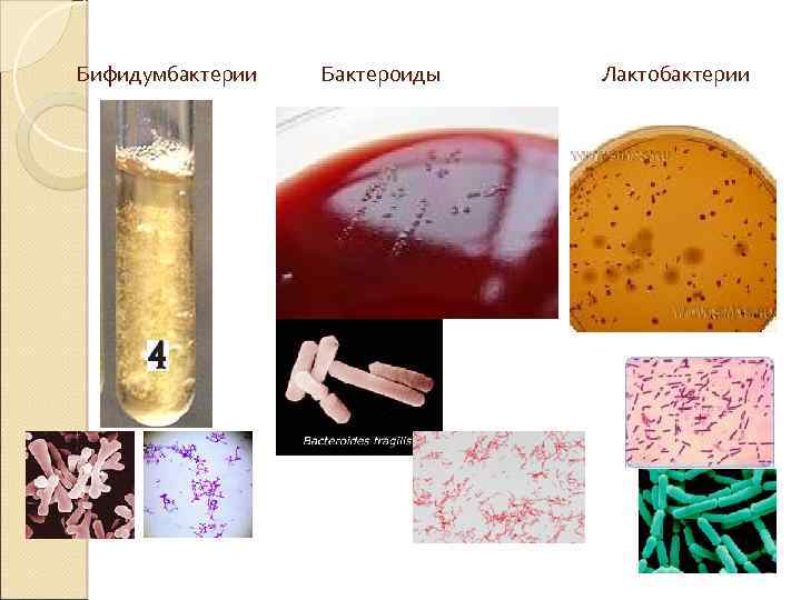 Бифидумбактерии Бактероиды Лактобактерии 