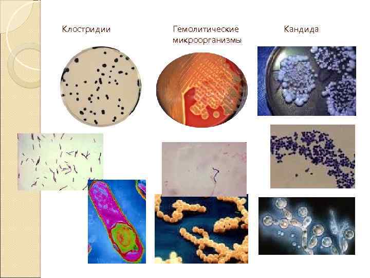 Клостридии Гемолитические микроорганизмы Кандида 