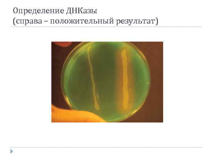 Определение ДНКазы (справа – положительный результат) 