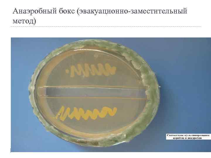 Анаэробный бокс (эвакуационно-заместительный метод) 
