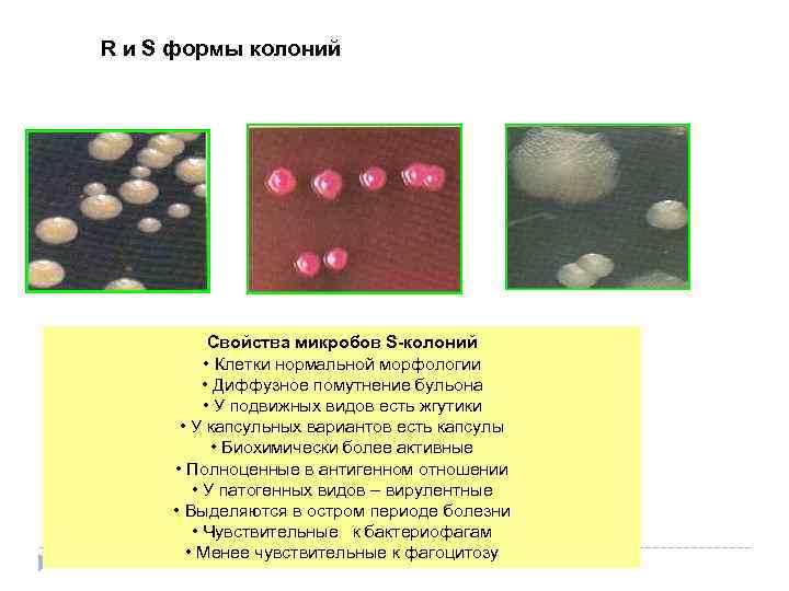 Какие виды колоний. Колонии s и r формы. R И S формы колоний бактерий. S И R формы бактерий. Характеристика s и r форм бактерий.