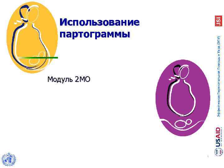 Модуль 2 МО Эффективная Перинатальная Помощь и Уход (ЭПУ) Использование партограммы 1 
