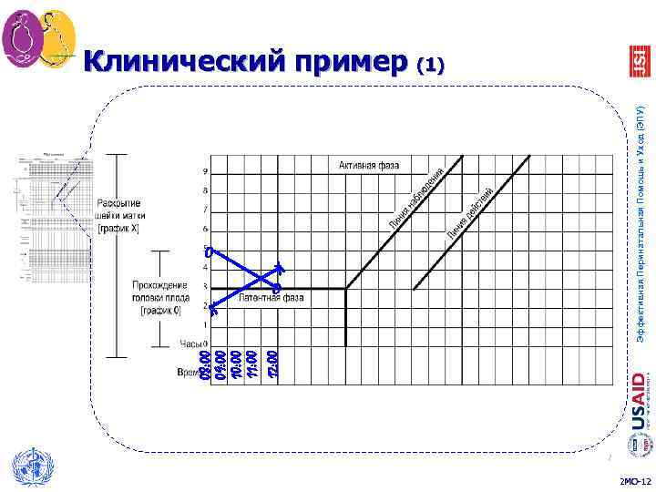 08: 00 09: 00 10: 00 11: 00 12: 00 O O X X