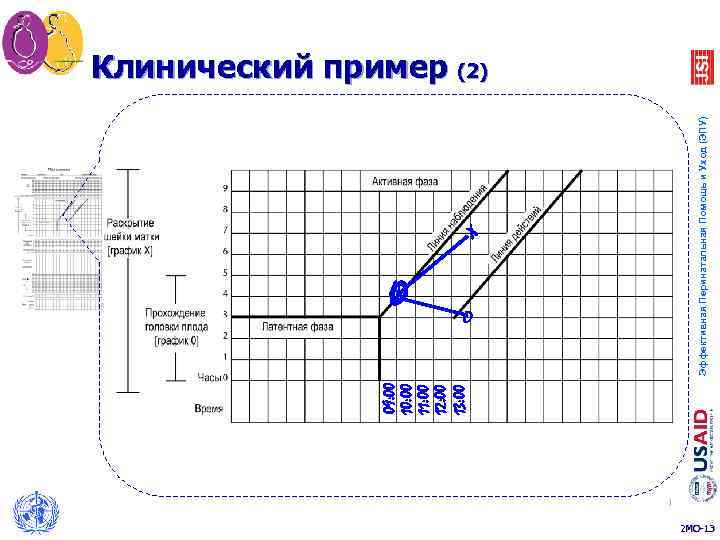 09: 00 10: 00 11: 00 12: 00 13: 00 X X O O