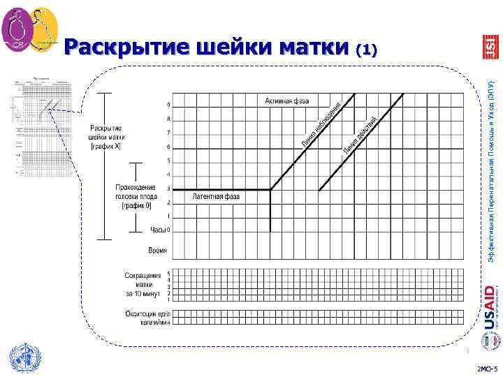 Партограмма в акушерстве как заполнять образец заполнения