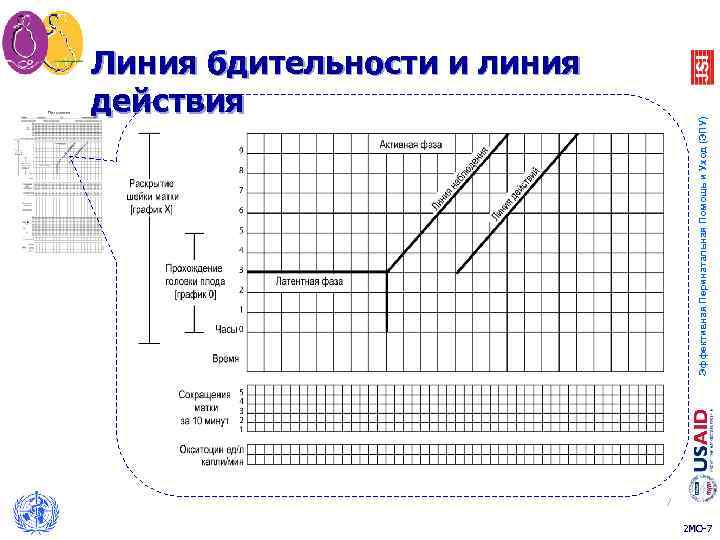 Партограмма в акушерстве образец