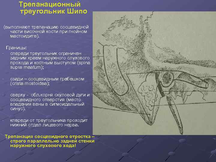 Трепанационный треугольник Шипо (выполняют трепанацию сосцевидной части височной кости при гнойном мастоидите). Границы: -