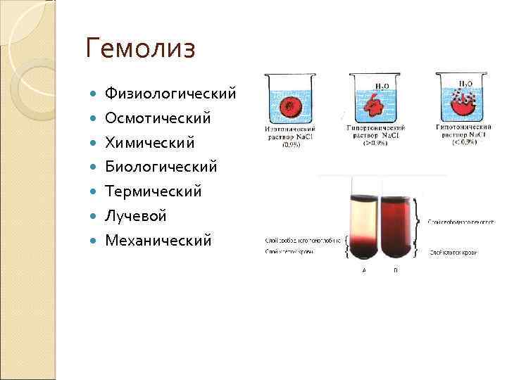 Гемолиз Физиологический Осмотический Химический Биологический Термический Лучевой Механический 