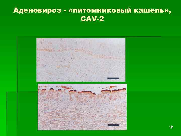 Аденовироз - «питомниковый кашель» , CAV-2 26 