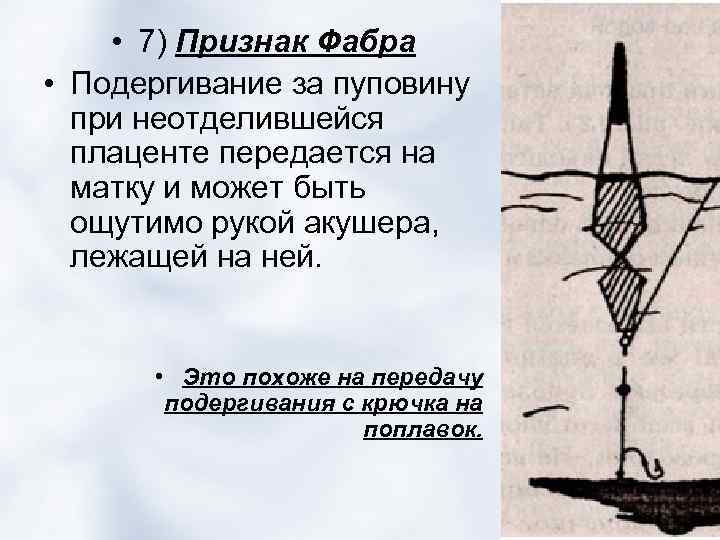  • 7) Признак Фабра • Подергивание за пуповину при неотделившейся плаценте передается на