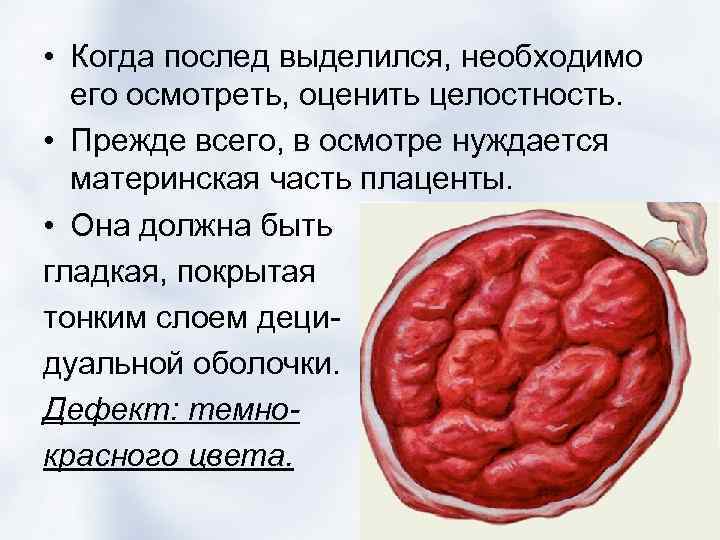  • Когда послед выделился, необходимо его осмотреть, оценить целостность. • Прежде всего, в