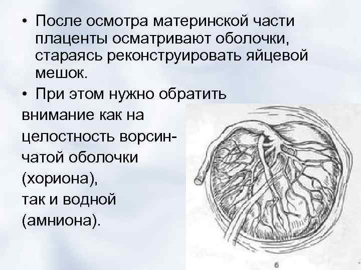  • После осмотра материнской части плаценты осматривают оболочки, стараясь реконструировать яйцевой мешок. •