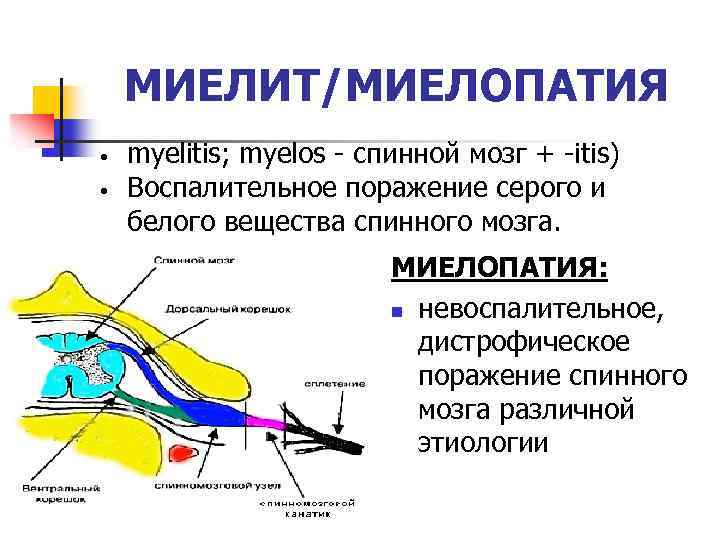 Миелит это. Цервикальный миелит. Миелопатии спинного мозга. Ишемическая миелопатия спинного мозга. Миелопатия неврология.