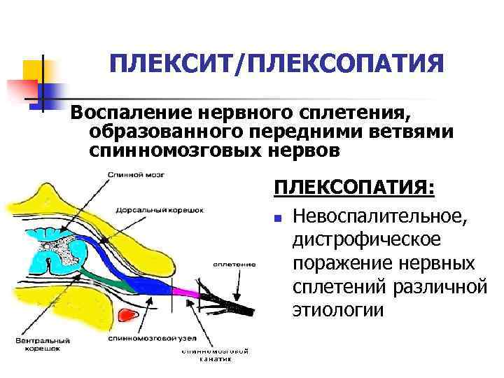 Заболевания периферической нервной системы неврология презентация