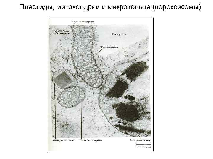 Пластиды, митохондрии и микротельца (пероксисомы) 