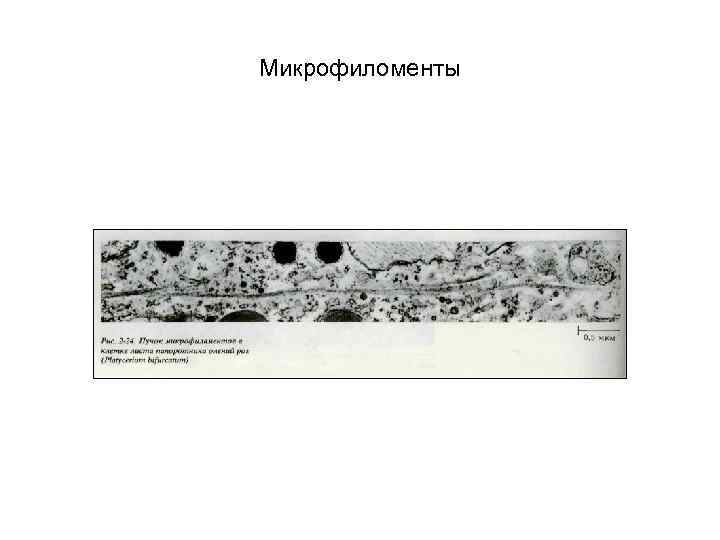 Микрофиломенты 