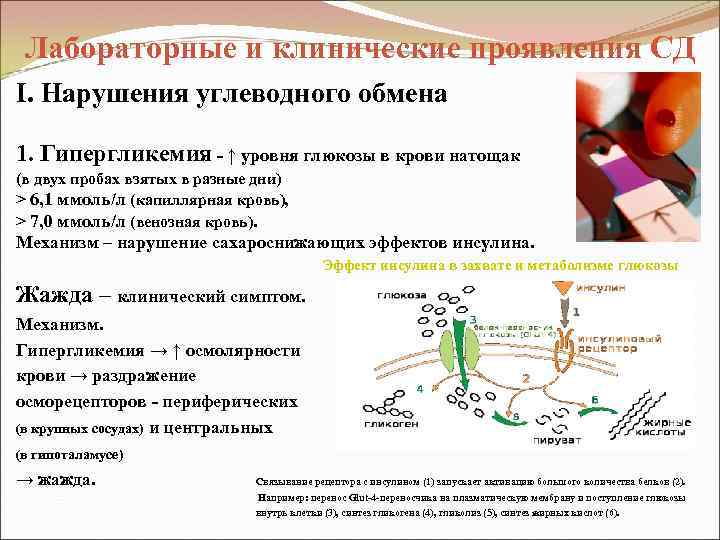 Лабораторные и клинические проявления СД I. Нарушения углеводного обмена 1. Гипергликемия - ↑ уровня