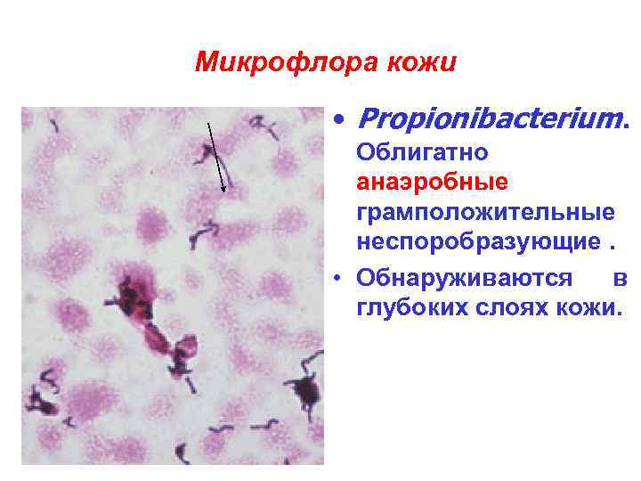 Микрофлора кожи • Propionibacterium. Облигатно анаэробные грамположительные неспоробразующие. • Обнаруживаются в глубоких слоях кожи.