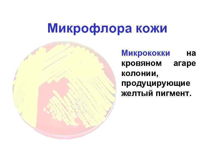 Микрофлора кожи • Микрококки на кровяном агаре колонии, продуцирующие желтый пигмент. 