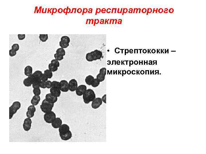 Микрофлора респираторного тракта • Стрептококки – электронная микроскопия. 