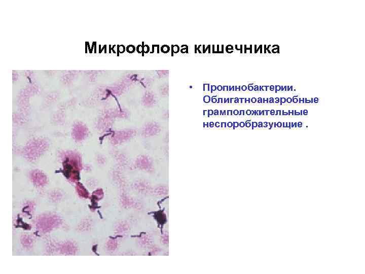 Микрофлора кишечника • Пропинобактерии. Облигатноанаэробные грамположительные неспоробразующие. 