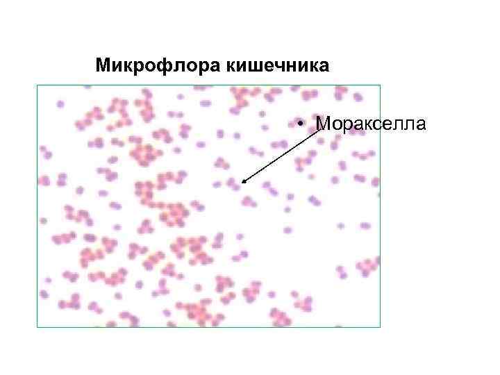 Микрофлора кишечника • Моракселла 