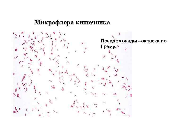 Микрофлора кишечника Псевдомонады –окраска по Граму. 