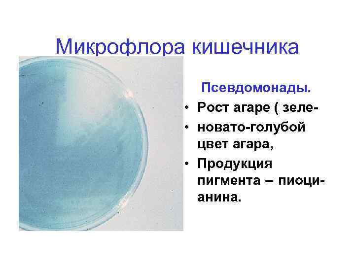 Микрофлора кишечника Псевдомонады. • Рост агаре ( зеле • новато-голубой цвет агара, • Продукция