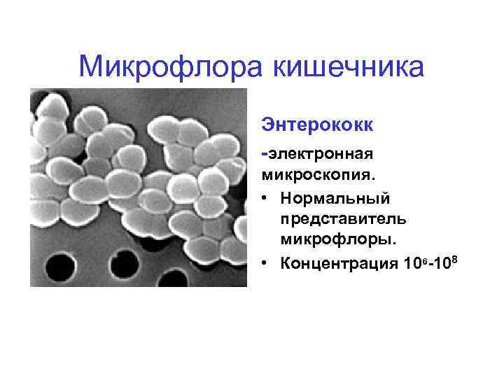 Какая микрофлора