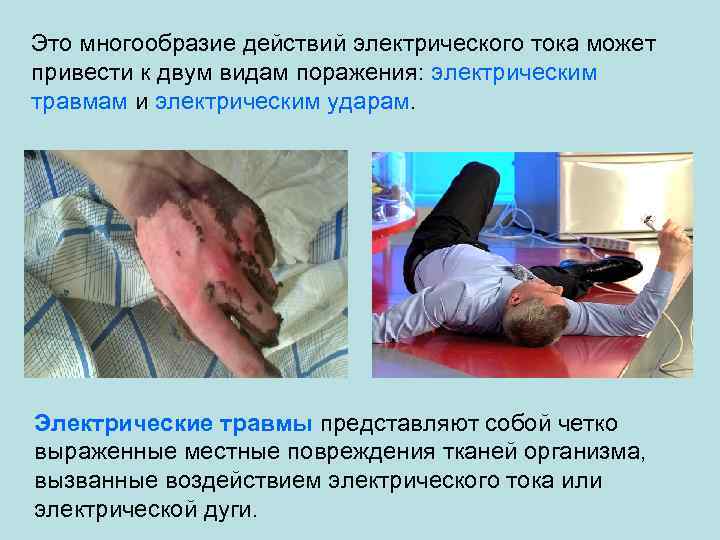 Это многообразие действий электрического тока может привести к двум видам поражения: электрическим травмам и