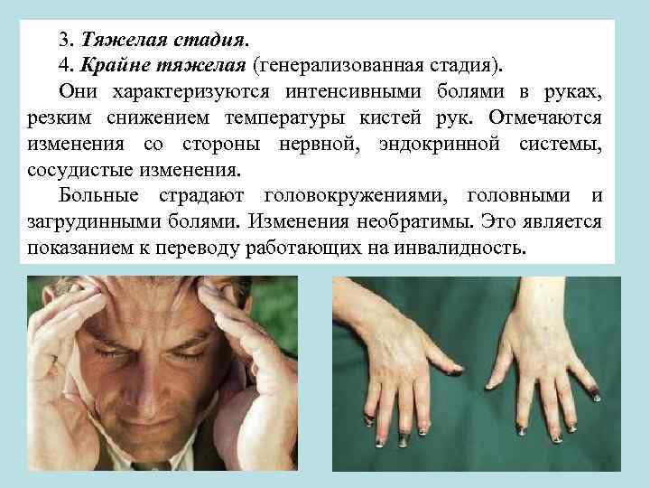 3. Тяжелая стадия. 4. Крайне тяжелая (генерализованная стадия). Они характеризуются интенсивными болями в руках,