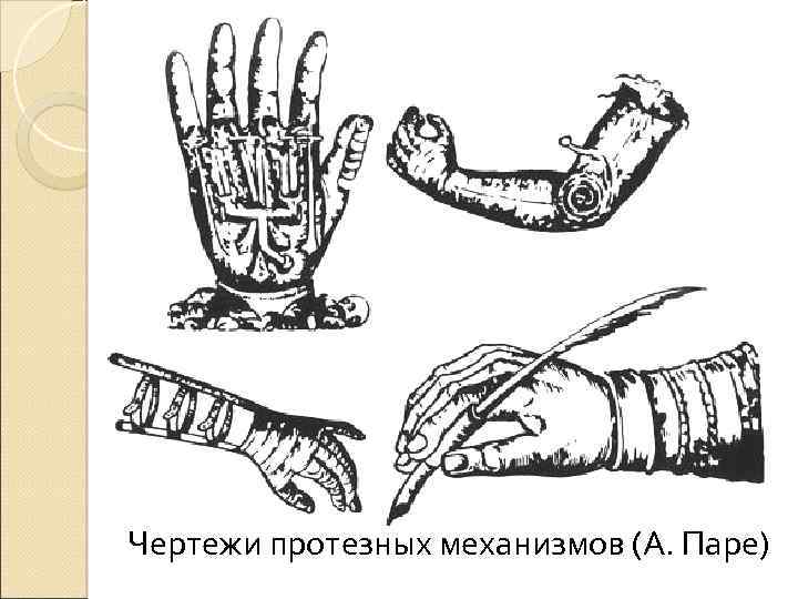 Чертежи протезных механизмов (А. Паре) 