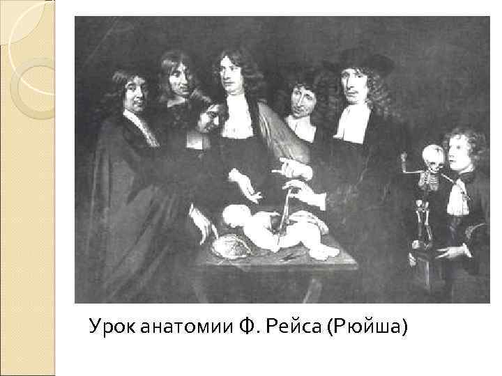 Урок анатомии Ф. Рейса (Рюйша) 