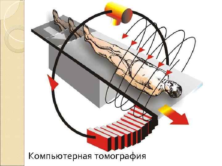 Компьютерная томография 