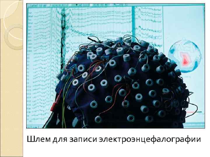 Шлем для записи электроэнцефалографии 