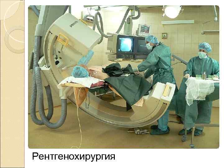 Рентгенохирургия 