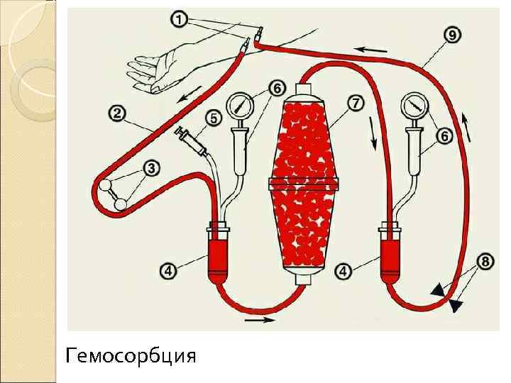 Гемосорбция 