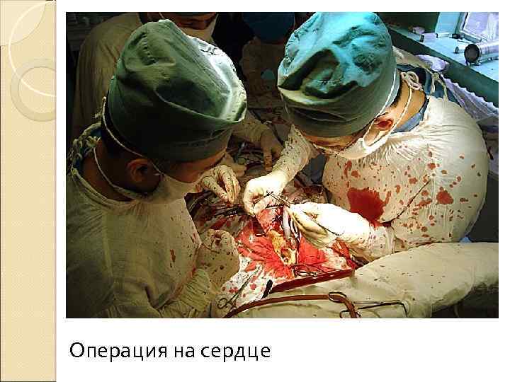 Операция на сердце 
