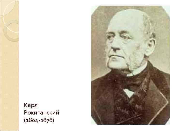 Карл Рокитанский (1804 -1878) 